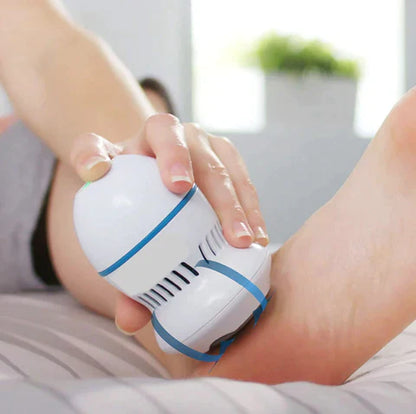 Auraelle Vacuum Callus Remover